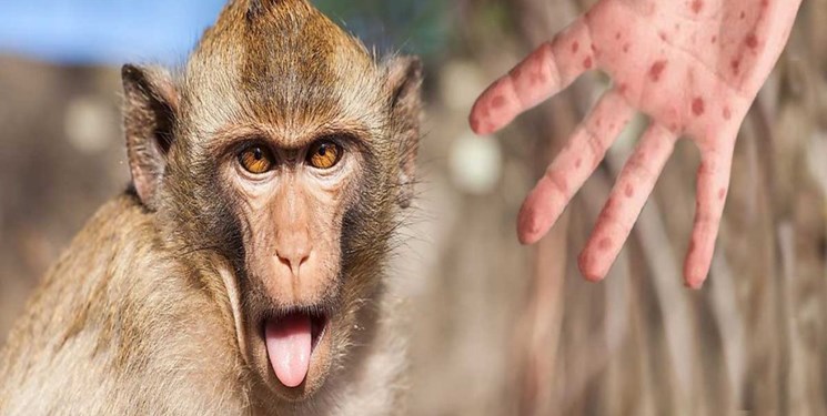 آبله میمون هنوز وارد ایران نشده است